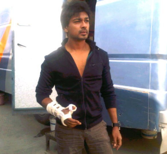 Nikhil Dwivedi to undergo surgery for his fractured hand!